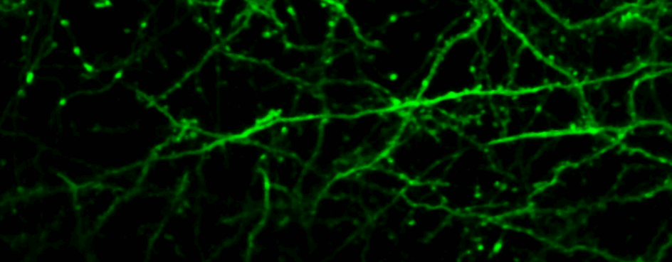 in-vivo imaging of dendrites and synapses