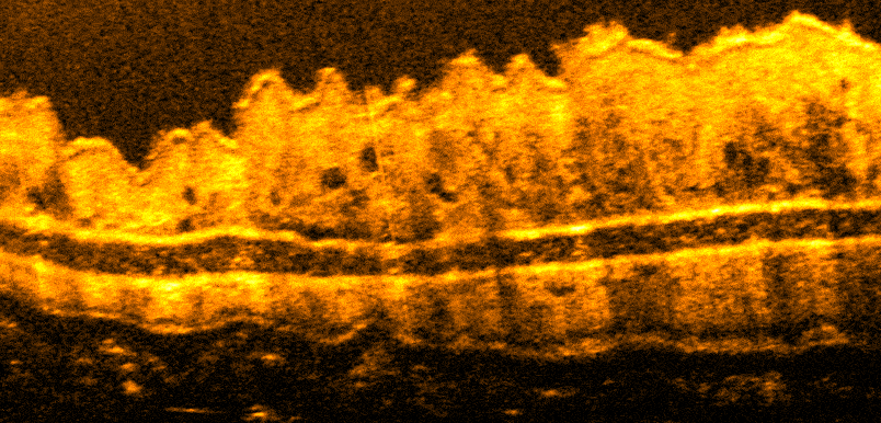 in-vivo OCT scan of mouse ear