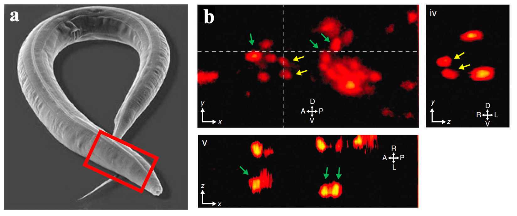 Whole brain imaging in C.Elegans