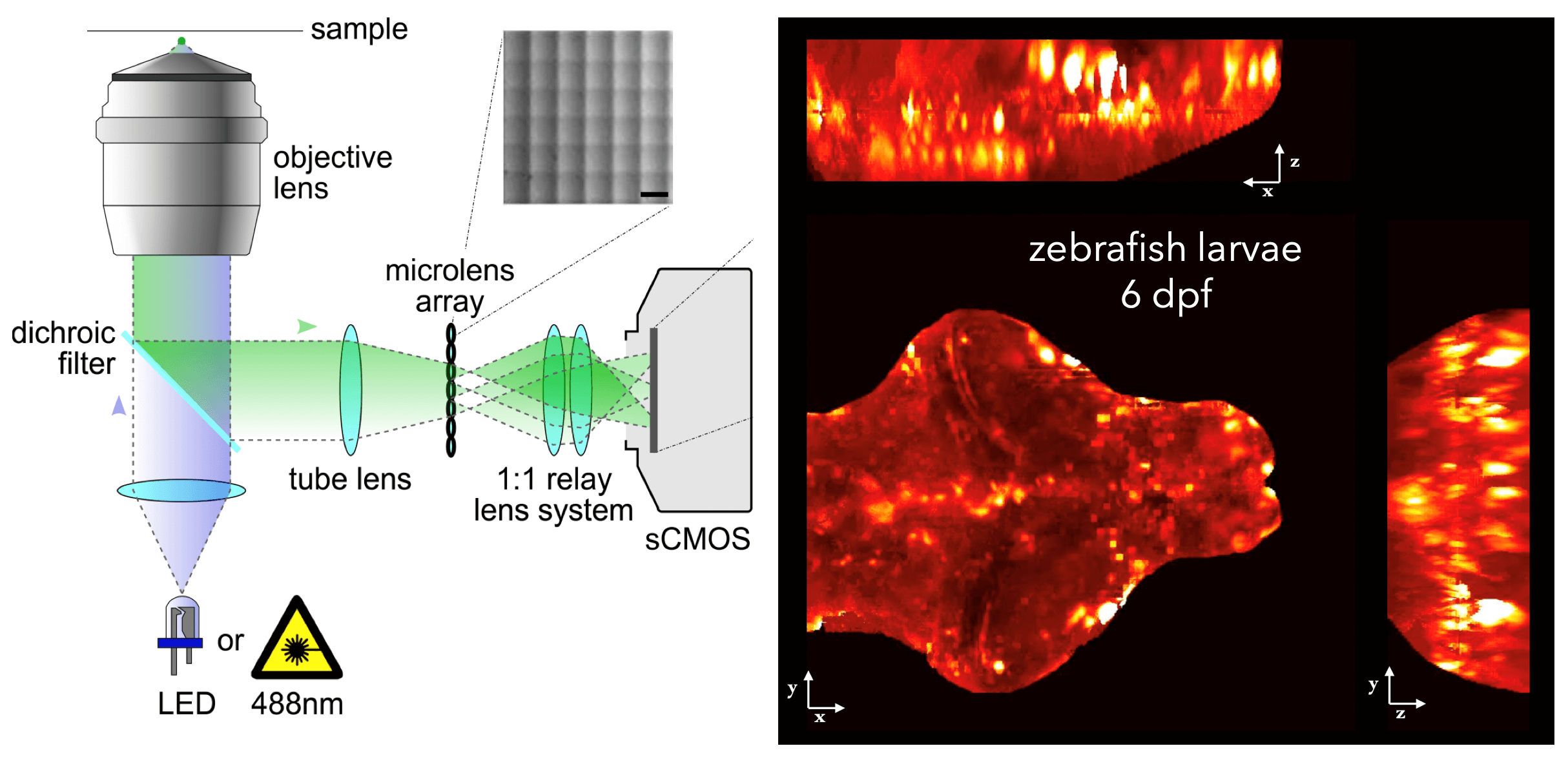 Light-field deconvolution microscopy